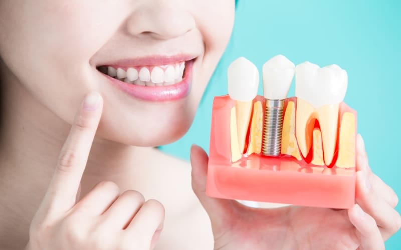 IZEN имплантация со скидкой 30%