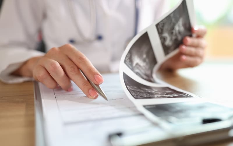 Современный обзор: β-блокада при критических состояниях (Intensive Care Medicine, август 2026)