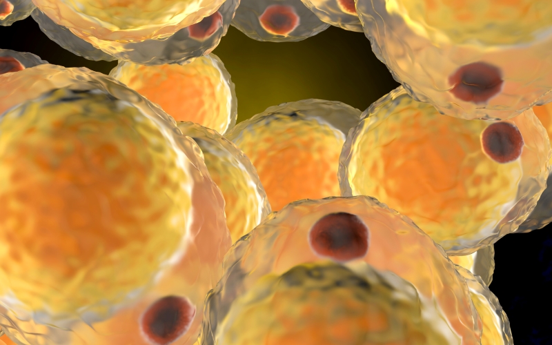 Ожирение у взрослых. Клинический протокол МЗ Казахстана