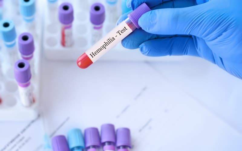 Десять подсказок по вызванной сепсисом тромбоцитопении (Intensive Care Medicine, май 2024)