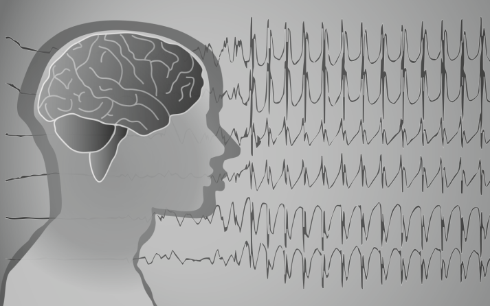 Эпилептический статус в отделении интенсивной терапии (Intensive Care Medicine, декабрь 2023)