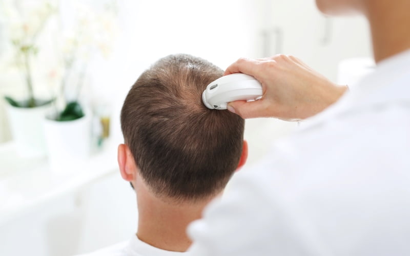 Очаговая алопеция (Nature Reviews Disease Primers, ноябрь 2025)