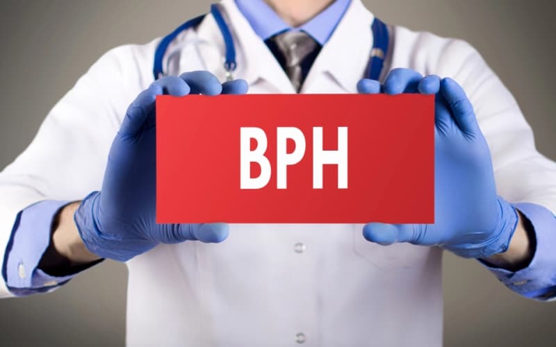 Доброкачественная гиперплазия предстательной железы. Клинический протокол МЗ Казахстана