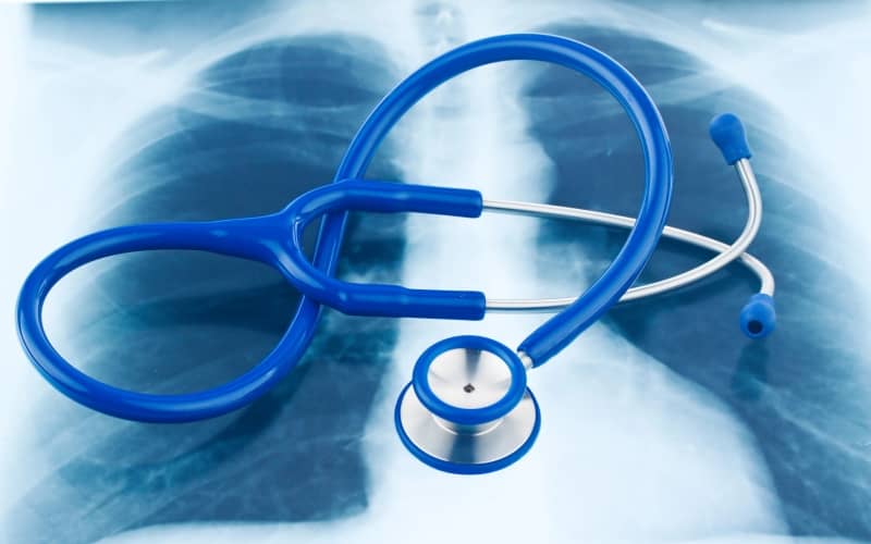 Злокачественное новообразование бронхов и легкого. Клинические рекомендации МЗ России