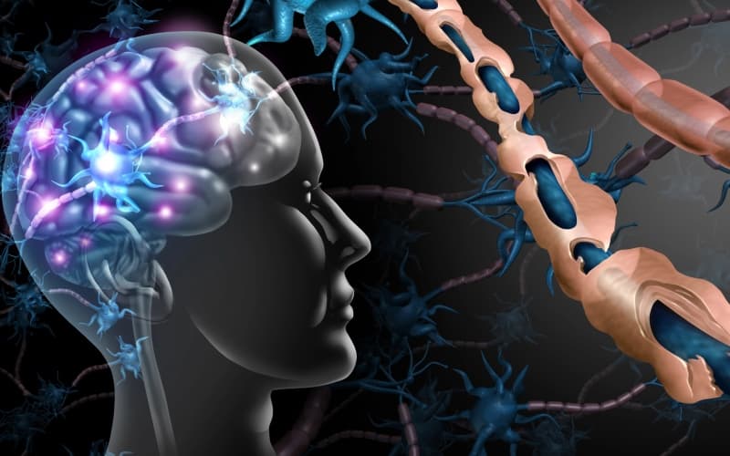 Обновление по оценке критериев смены лечения при рассеянном склерозе (Expert Review of Neurotherapeutics, май 2025)
