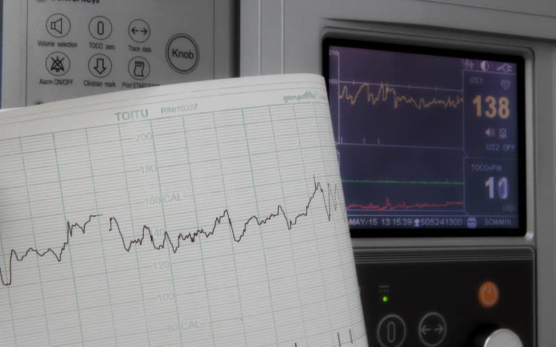 Фибрилляция предсердий и сердечная недостаточность (Heart Failure Reviews, февраль 2026)