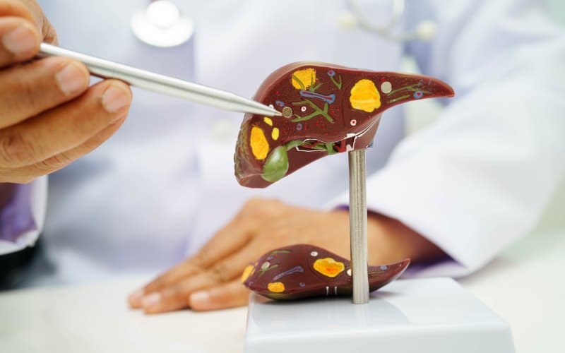 Болезнь Вильсона. Клинический протокол МЗ Беларуси