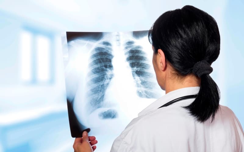 Нерезектабельный немелкоклеточный рак легкого III стадии: современное состояние и проблемы (Nature Reviews Clinical Oncology, октябрь 2025)