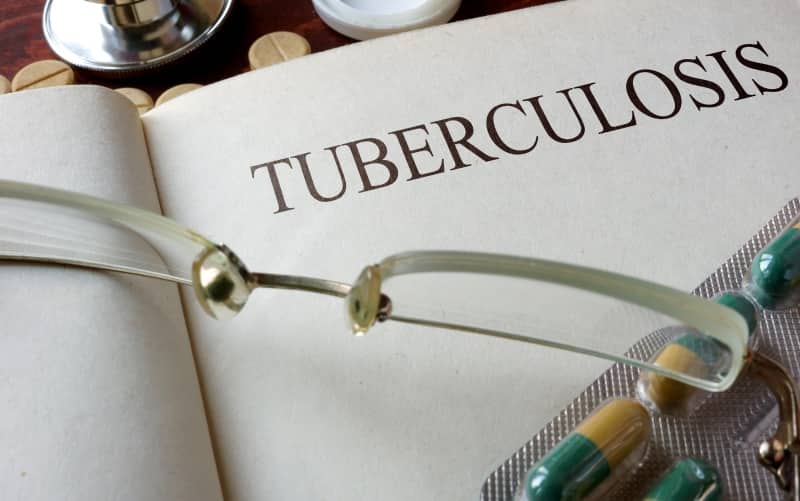 Внелегочный туберкулез. Клинический протокол МЗ Кыргызстана