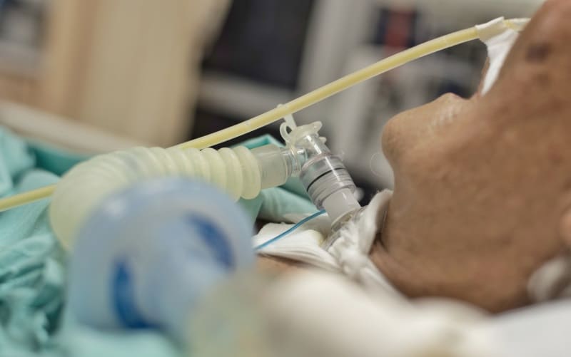 Внедрение защиты диафрагмы во время инвазивной искусственной вентиляции легких (Intensive Care Medicine, май 2024)