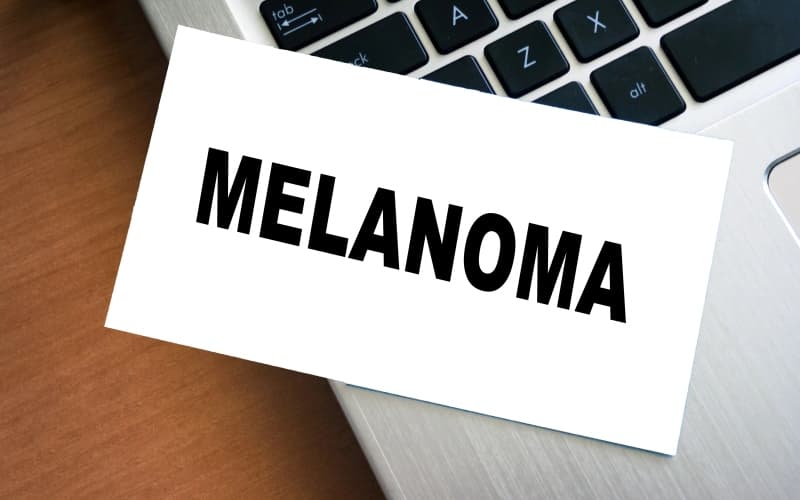 Иммунотерапия при меланоме: динамичный рубеж в лечении рака (Current Treatment Options in Oncology, январь 2026)