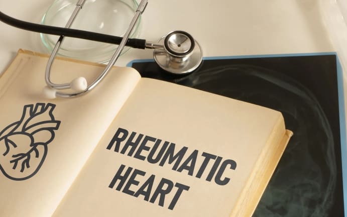 Острая ревматическая лихорадка и хроническая ревматическая болезнь сердца. Клиническое руководство МЗ Кыргызстана