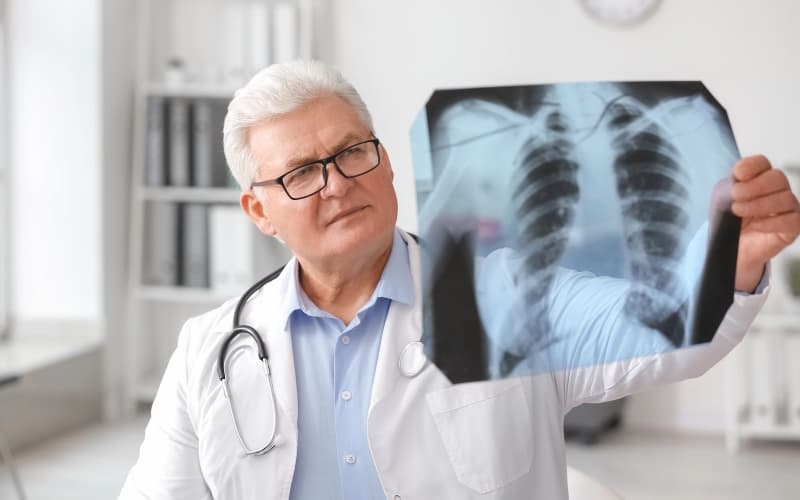 Лечение мукормикоза легких: современные концепции (Expert Review of Anti-infective Therapy, январь 2026)