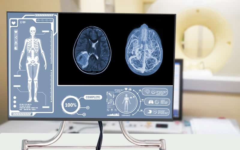 Оценка протокола магнитно-резонансной томографии STAT MRI у пациентов с отеком диска зрительного нерва (Journal of Neuro-Ophthalmology, декабрь 2024)