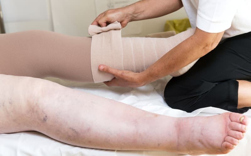 Острая ишемия конечностей. Клинические рекомендации МЗ России