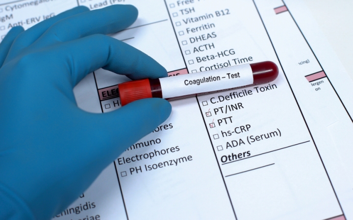 Как персонализировать тромбопрофилактику после тотального эндопротезирования (Journal of Thrombosis and Haemostasis, январь 2024)
