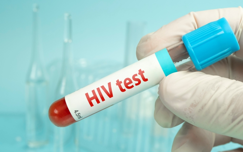 ВИЧ-инфекция. Клинические протоколы МЗ Кыргызстана