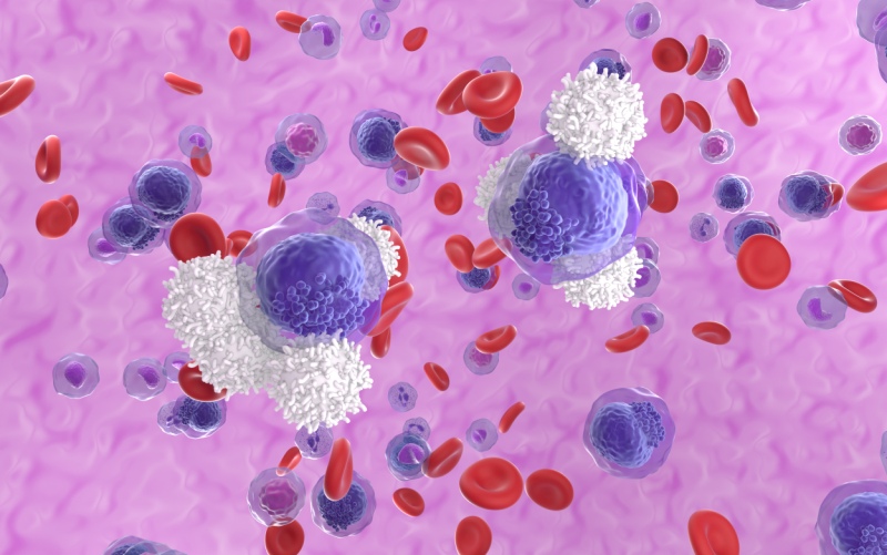 Стандартизация систем классификации острого миелоидного лейкоза (Lancet Haematology, август 2023)