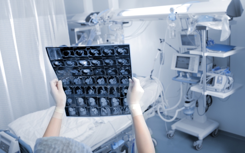 Обновление по унифицированной терминологии по кардио-КТ (Journal of Cardiovascular Computed Tomography, июнь 2023)