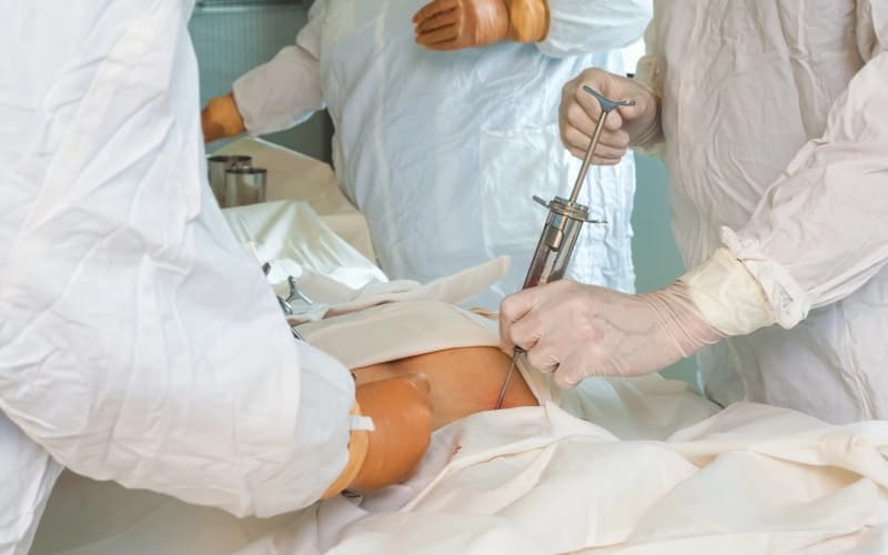 Аллогенная трансплантация гемопоэтических стволовых клеток при апластической анемии: современные данные, противоречия и принятие практических решений (American Journal of Hematology, апрель 2026)