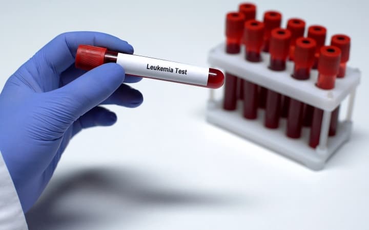 Хронический лимфолейкоз (Lancet, июль 2024)
