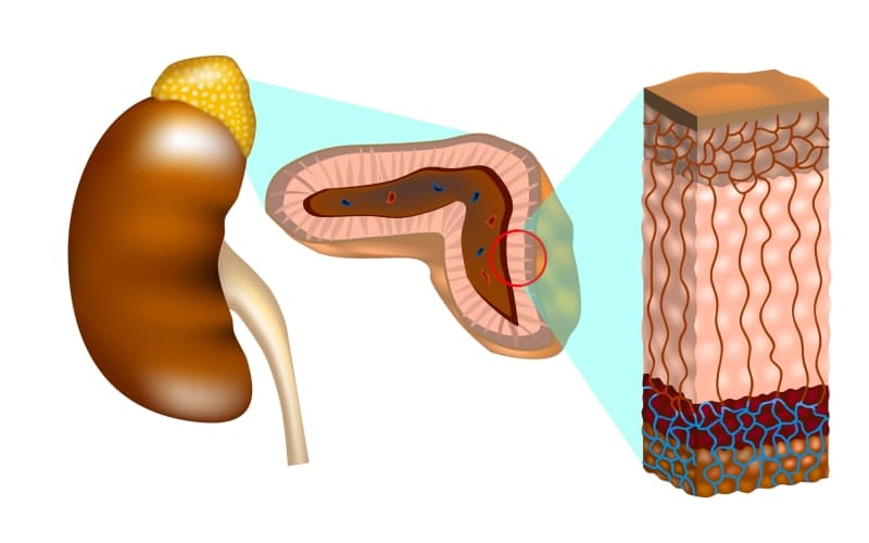 Новые возможности лечения карциномы коры надпочечников (Current Opinion in Endocrinology, Diabetes and Obesity, июль 2025)