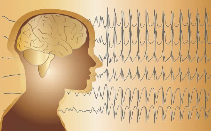 Эпилепсия (Continuum: Lifelong Learning in Neurology, февраль 2025)