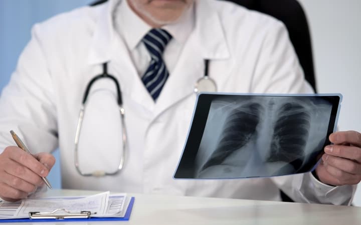 Новое поколение иммунотерапевтических средств для лечения рака легкого (Nature Reviews Clinical Oncology, июнь 2025)