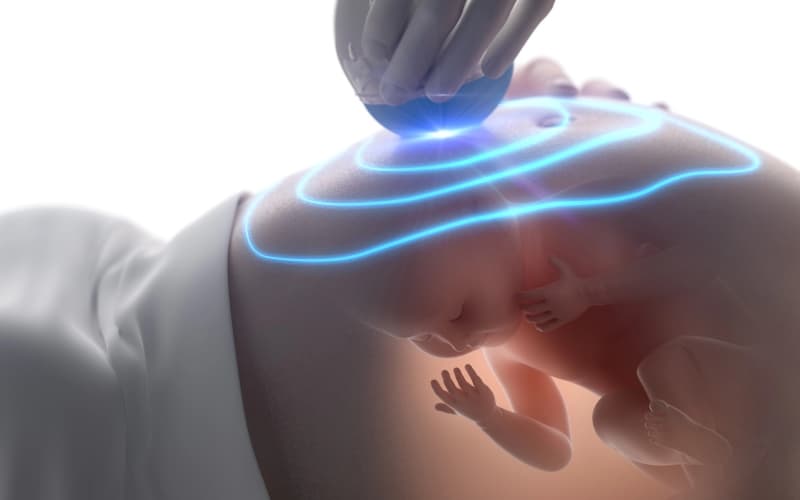 Крестцово-копчиковая тератома у новорожденных. Клинический проткол МЗ Казахстана