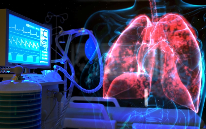 Мониторинг состояния дыхательной системы во время вено-венозной экстракорпоральной мембранной оксигенации (Perfusion, декабрь 2023)