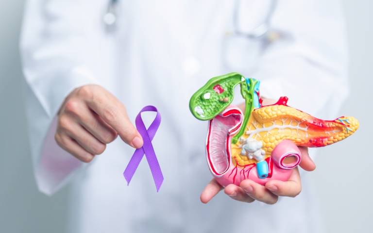 Рак поджелудочной железы. Клинический протокол МЗ Казахстана