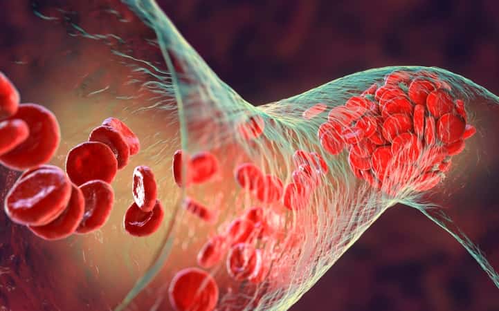 Фармакологическая тромбопрофилактика у детей (Blood, май 2025)