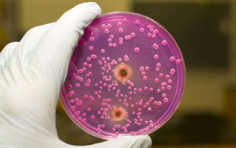 Проблемы в лечении инвазивных грибковых инфекций при трансплантации стволовых клеток (Transplant Infectious Disease, октябрь 2023)