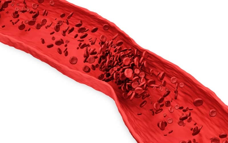 Лечение тромбоза у онкологических больных, развивающегося на фоне антикоагулянтной терапии (Blood, январь 2026)