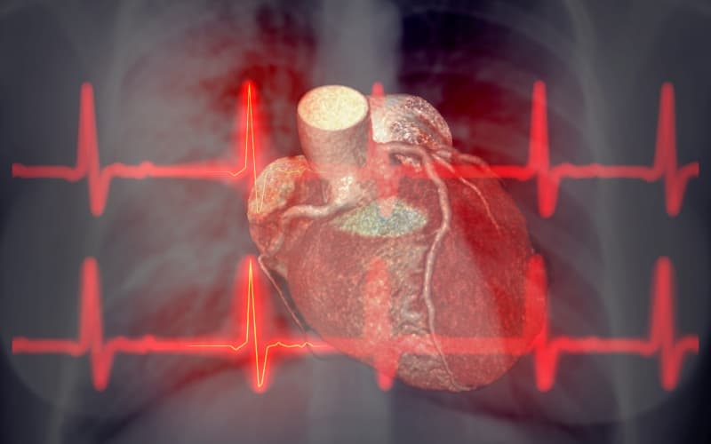 Кардиогенный шок: диагностика, фенотипирование и лечение (Intensive Care Medicine, август 2025)