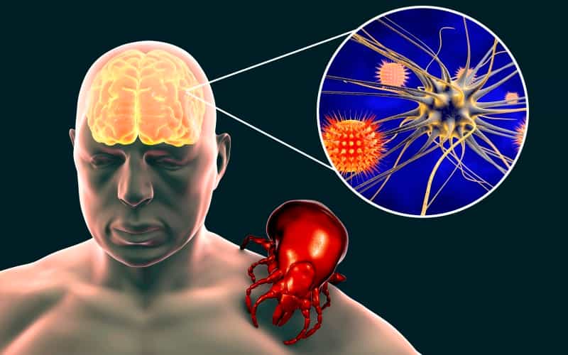 Клещевой вирусный энцефалит у взрослых. Клинический протокол МЗ России