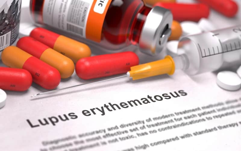  Системная красная волчанка. Клинические рекомендации МЗ России