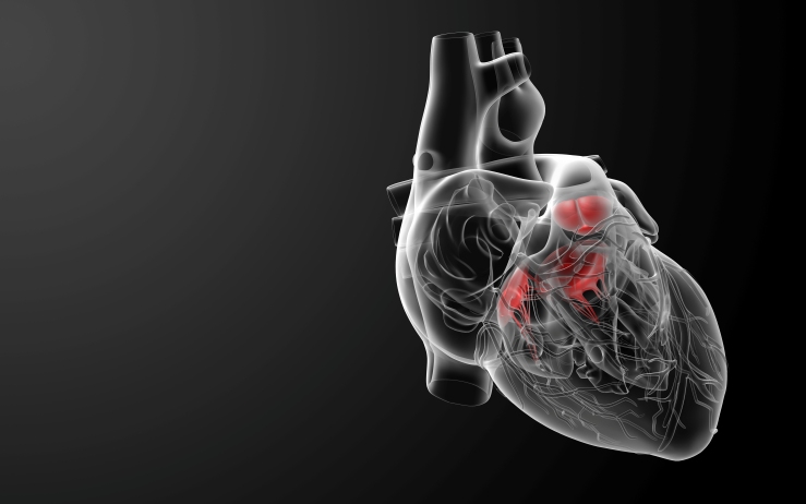 Ятрогенная атриовентрикулярная блокада (Cardiology Clinics, август 2023)