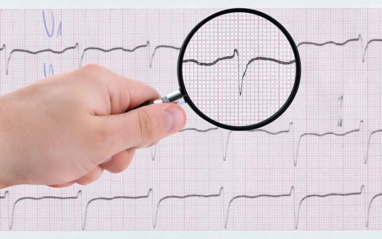Клиническое и визуализационное профилирование рестриктивных кардиомиопатий: понимание амилоидозного, саркоидозного фенотипов и фенотипа перегрузки железом (Heart Failure Reviews, март 2026)