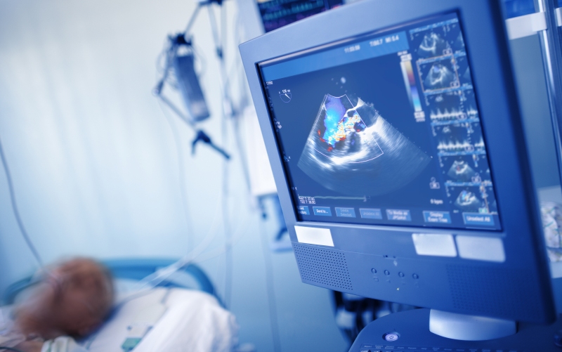 Стадирование кардиомиопатии Фабри с помощью эхокардиографии (JACC, октябрь 2023)