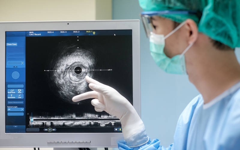 Перфорации при ЧКВ по поводу хронической тотальной окклюзии (Cardiovascular Revascularization Medicine, сентябрь 2023)