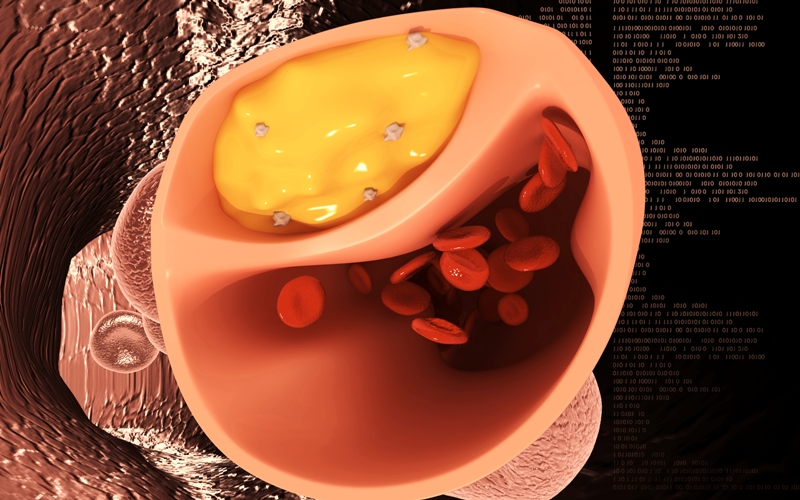 Методы визуализации для оценки стеноза и атеросклероза коронарных артерий (Quantitative Cardiovascular Imaging Study Group, июнь 2023)