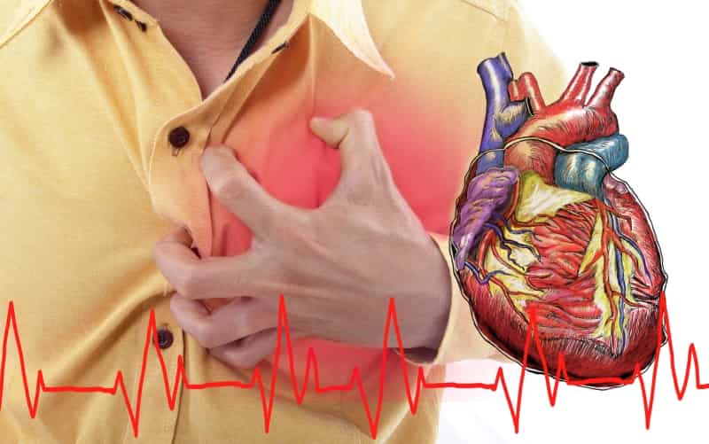 Заболевания перикарда и лучшая практика по перикардиоэктомии (JACC, июль 2024) 