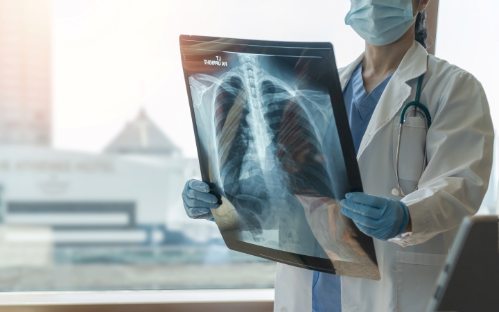 Туберкулезная инфекция. Клинический протокол МЗ Кыргызстана