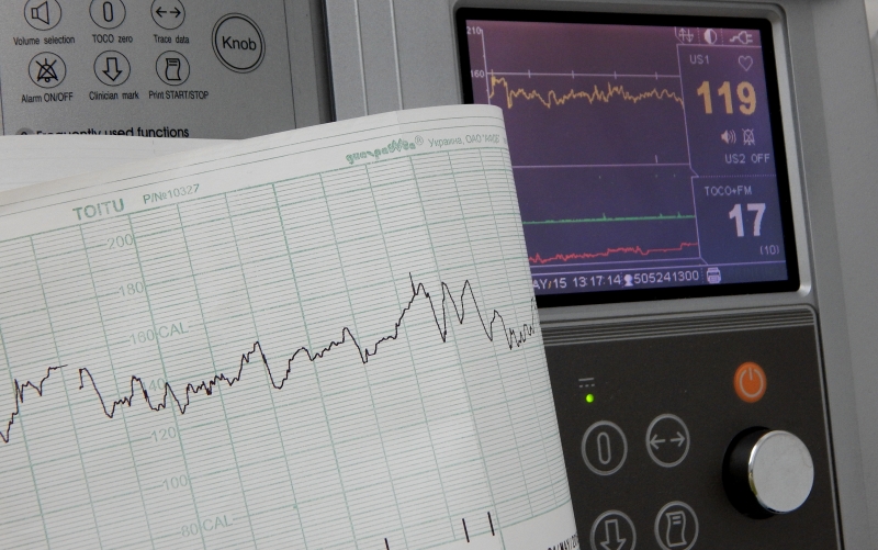 Эпидемиология, патофизиология, диагностика и лечение хронической правожелудочковой сердечной недостаточности и трикуспидальной регургитации (European Journal of Heart Failure, декабрь 2023)