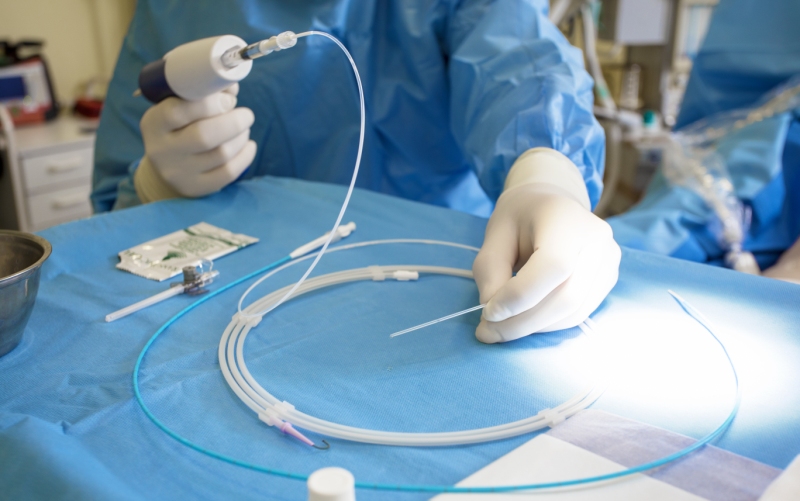 Эндоваскулярная тромбэктомия за пределами 24-х часов (Journal of NeuroInterventional Surgery, июнь 2023)