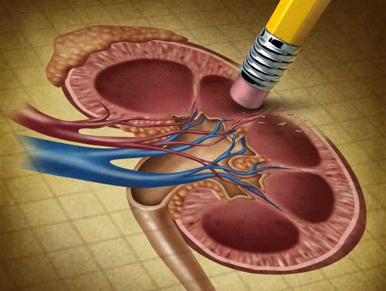  Хроническая болезнь почек (Annals of Internal Medicine, сентябрь 2025)