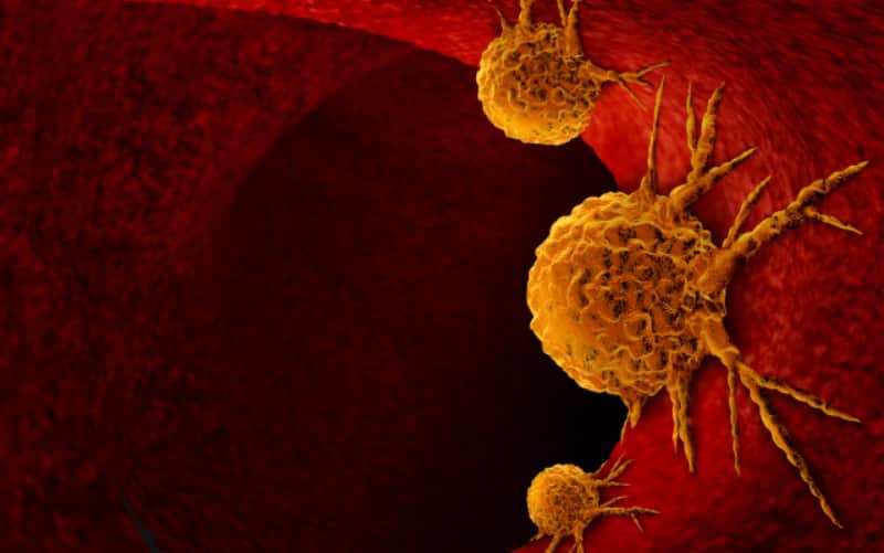 Ингибиторы менина: новая эра таргетной терапии острого миелоидного лейкоза (Current Treatment Options in Oncology, март 2026)