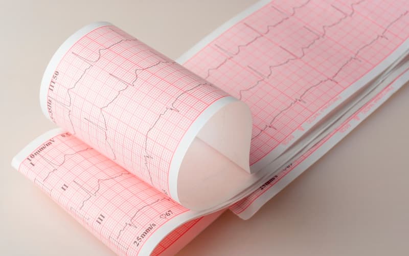 2026 Руководство по лечению дислипидемии (ACC/AHA/AACVPR/ABC/ACPM/ADA/AGS/APhA/ASPC/NLA/PCNA, март 2026)