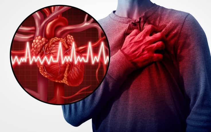 Документ JACC: Heart Failure – лечение ишемической болезни сердца у пациентов с сердечной недостаточностью (JACC: Heart Failure, декабрь 2025)